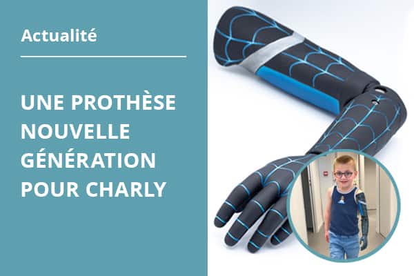 image-prothese-charly